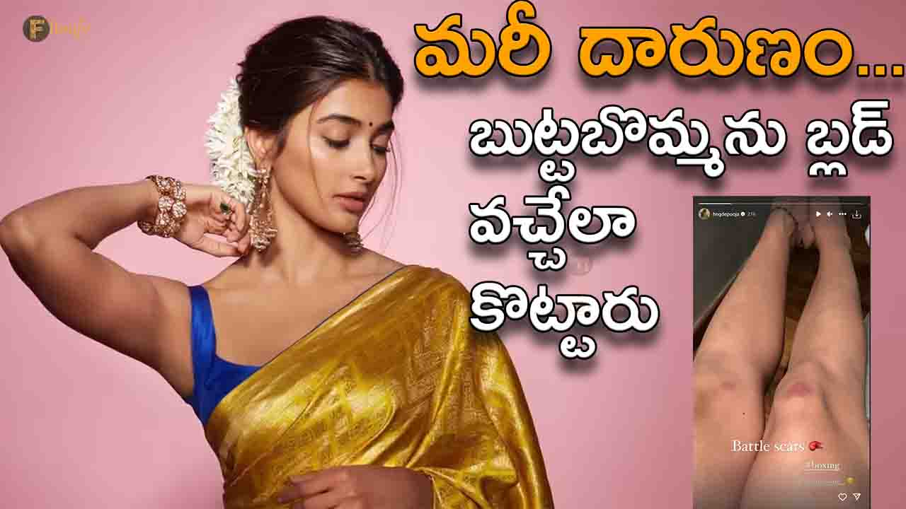 Actress Pooja Hegde thrashed to the point of bleeding