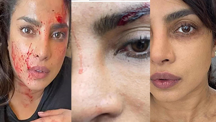 priyanka-chopra- is in a terrible condition with bloody wounds on her face